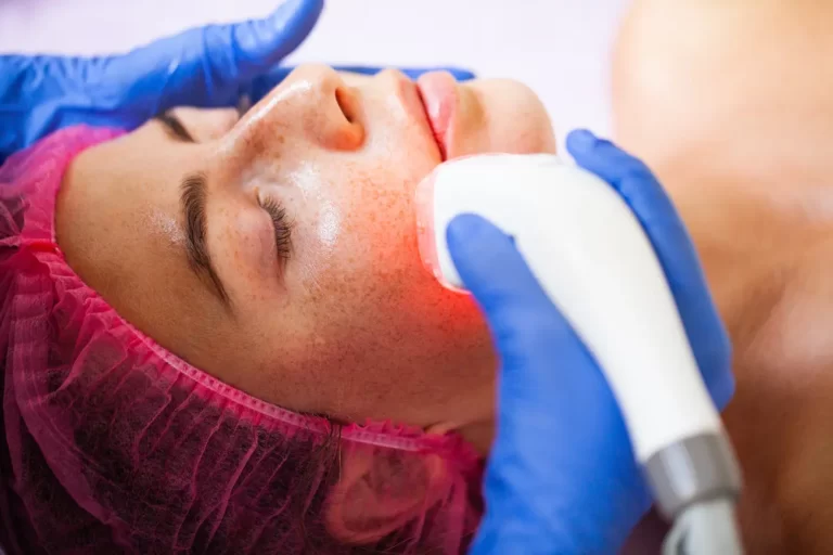 Laser na twarz – w jaki sposób poprawia kondycję skóry? 1 woman getting lpg hardware massage at the beauty c 2023 11 27 05 31 13 utc